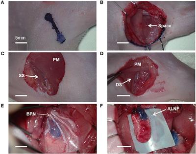 Anatomy and relationships of forelimb lymph nodes in Sprague-Dawley rats: A detailed dissecting approach